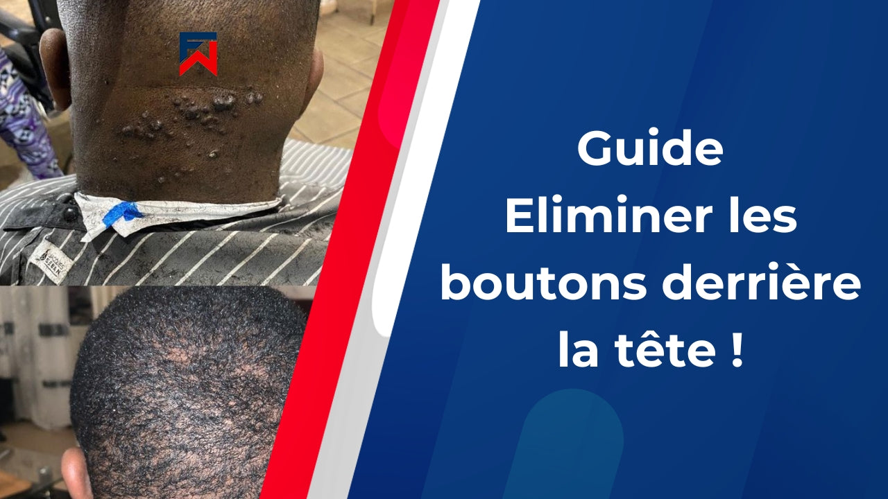 Solution efficace contre les boutons derrière la tête French Waver