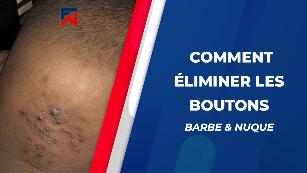 Comment éliminer les boutons sous la barbe et derrière la nuque ?