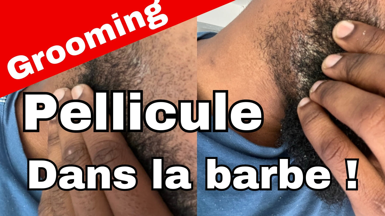 Pourquoi j'ai des péllicules dans ma barbe ?