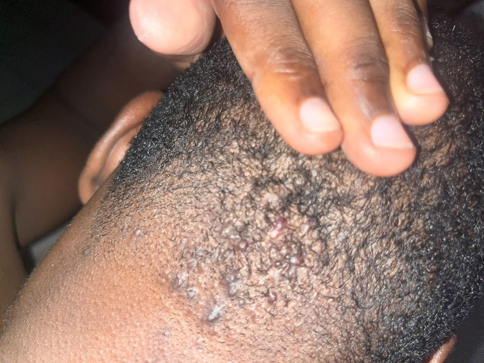 Boutons derrière la tête