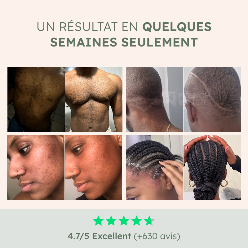 Boutons derrière la tête | Kit de Soin