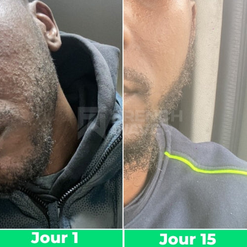 Avant / Après de Yanis B.