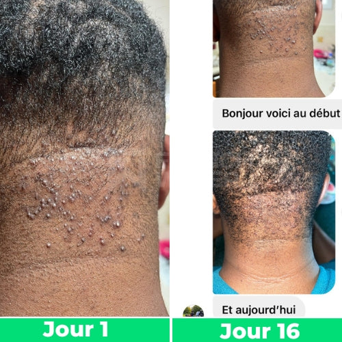 Avant / Après de Remy.J