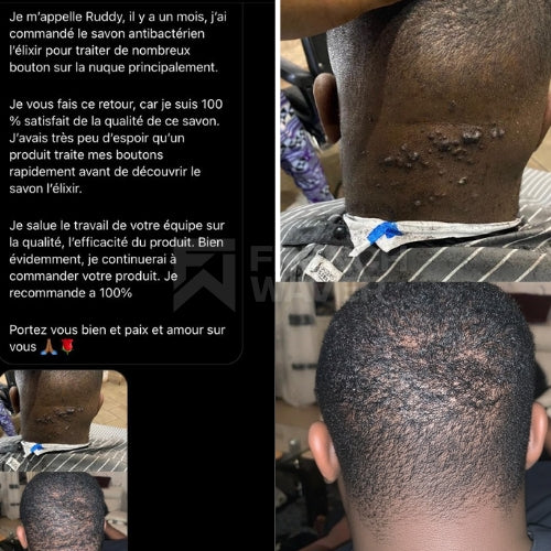 Avant / Après de Ruddy W.