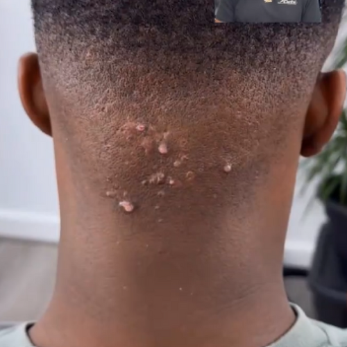 Boutons derrière la tête