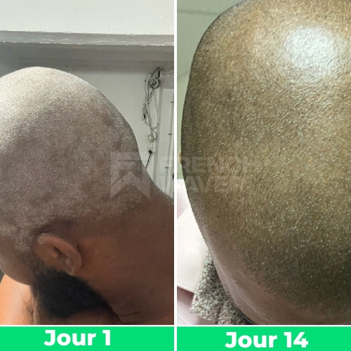 Avant / Après de Jean-Baptiste
