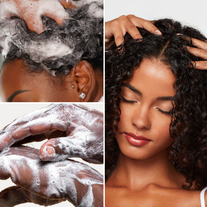 Psoriasis & Dermatite Séborrhéique