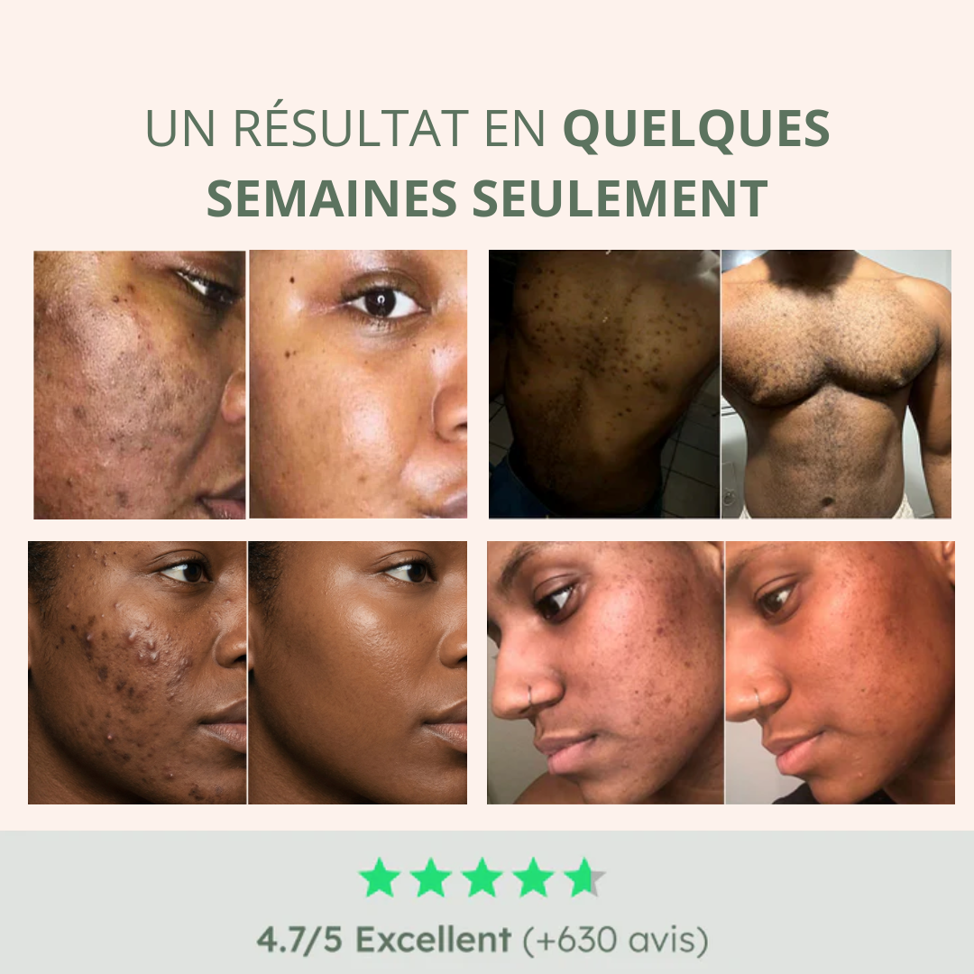 Kit Peau Parfaite