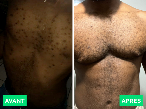 Avant / Après de Kevin M.