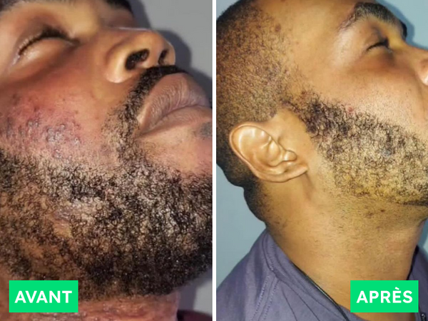 Avant / Après de Idriss K.