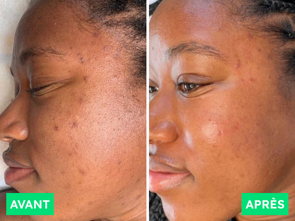 Avant / Après de Mariam S.