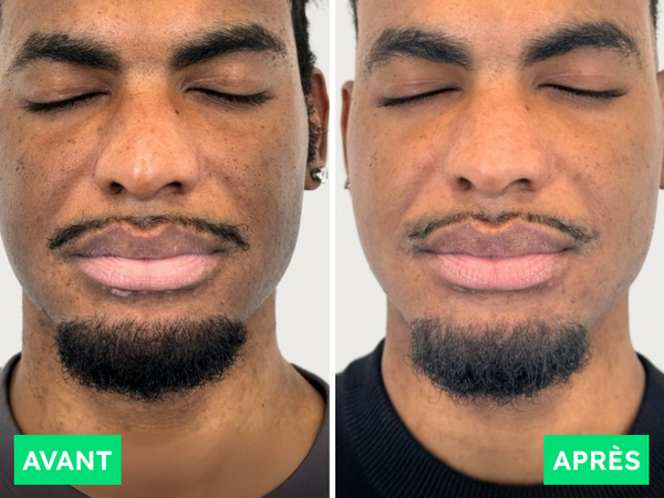 Avant / Après de Junior A.