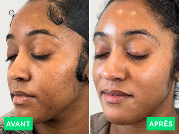 Avant / Après de Marième D.