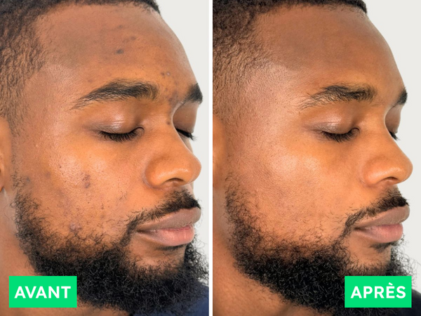 Avant / Après de Kevin L.