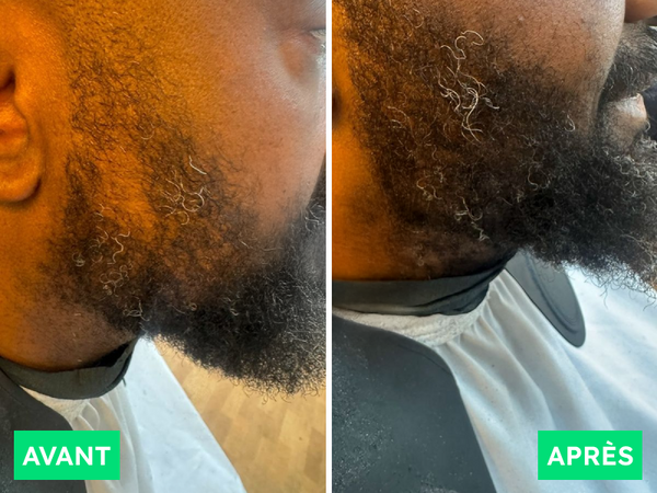 Avant / Après de John A.