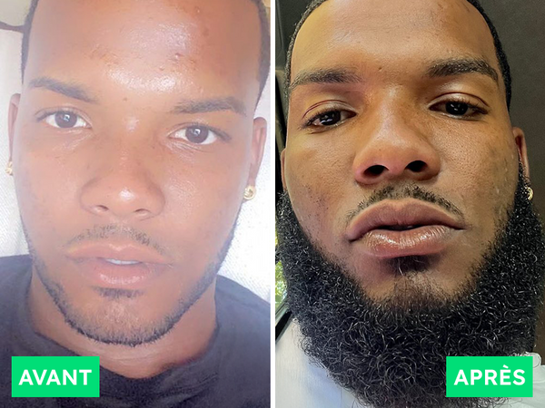 Avant / Après de Idriss T.