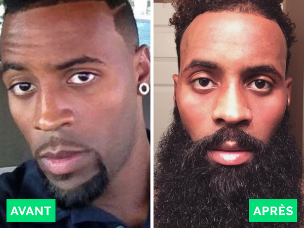 Avant / Après de Franck F.