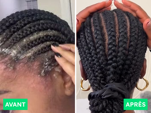 Avant / Après de Moussa K.