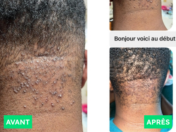 Avant / Après de Remy J.