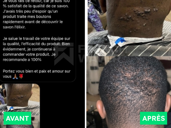 Avant / Après de Ruddy W.