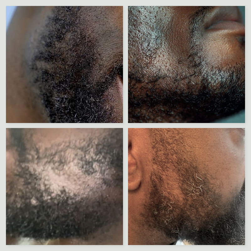 Huile de barbe Aphrodisiaque