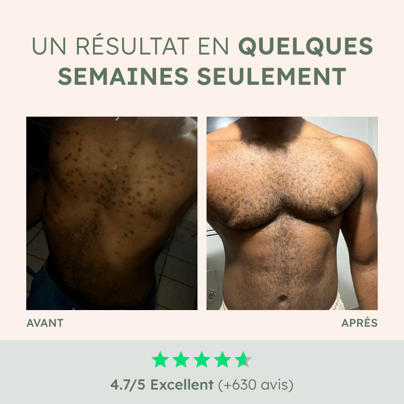 Gommage Anti-Poils incarnés