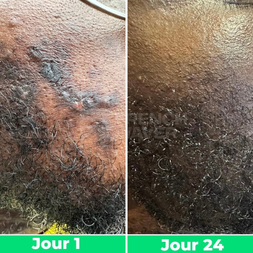 Avant / Après de Siméon.K