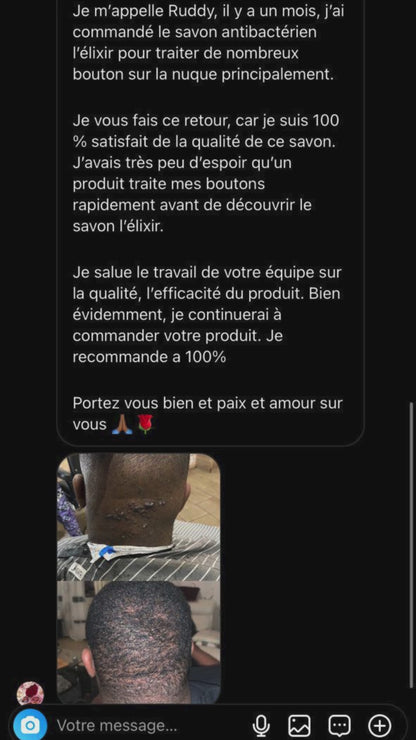 Kit de soin pour les boutons derrière la tête