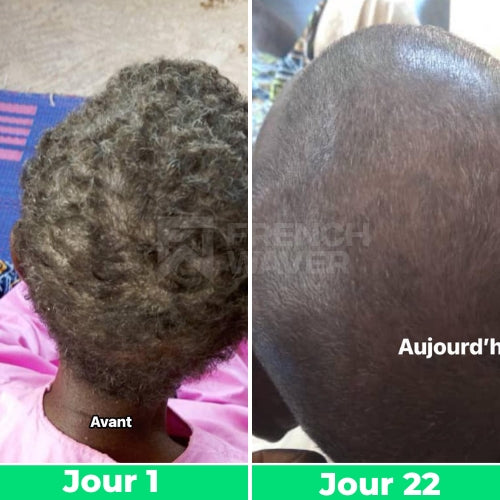 Avant / Après de Kevin A.