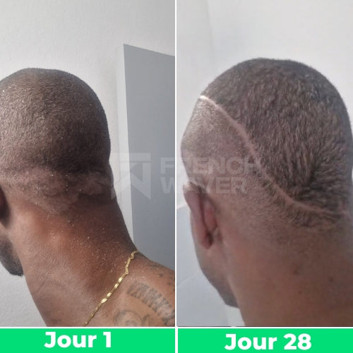 Avant / Après de Prénom P.