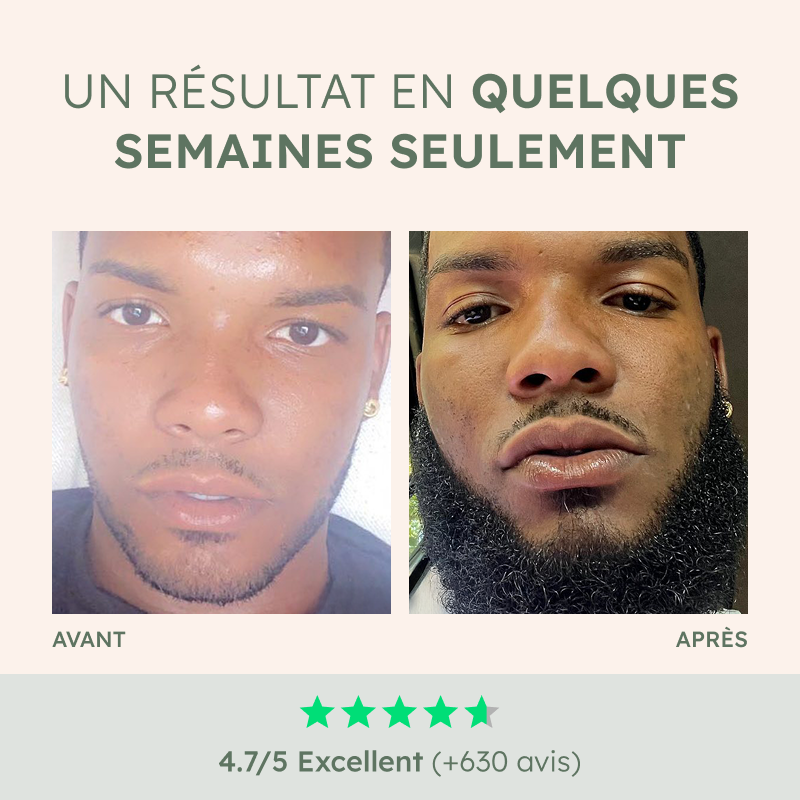Huile de barbe Aphrodisiaque